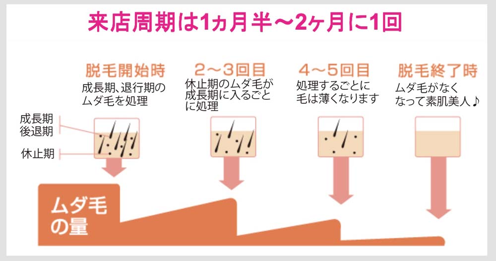 国産最新脱毛機器を使用